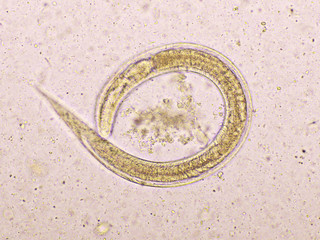 Strongyloides stercoralis or threadworm in human stool, analyze by microscope, original...