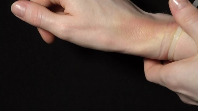Female hands with a big bruise on a black background. Domestic violence or unequal treatment. Treatment with bruise ointments. 4k footage.