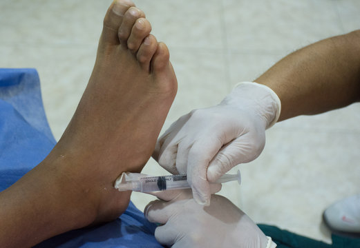 terapia neural esguinse de tobillo