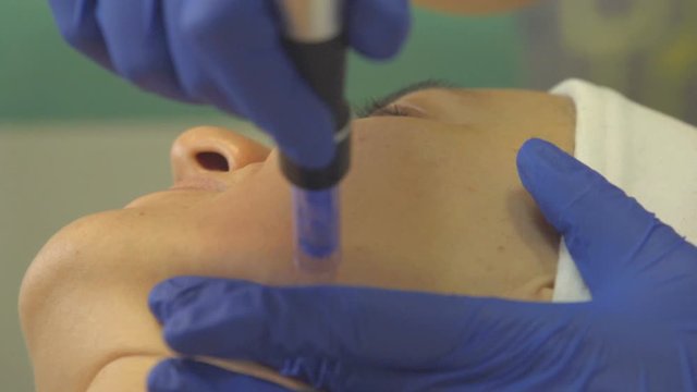 Cosmetologist making mesotherapy injection. Microneedle mesotherapy. Close up, slow motion