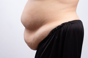 Women body very fat belly. Health care concept.