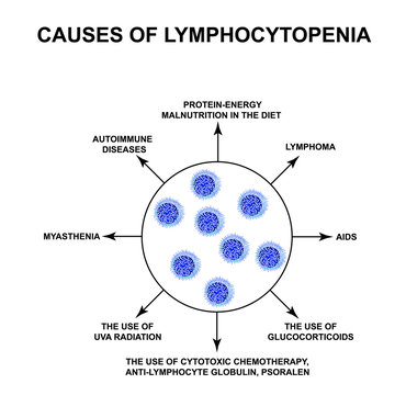 Causes of lymphocytopenia. Decreased lymphocytes in the blood. Infographics. Vector illustration on isolated background.