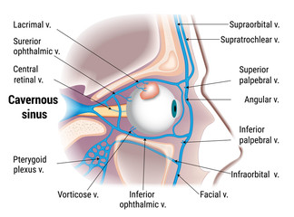Pathogenesis of cavernous sinus thrombosis. Study guide, vector illustration.