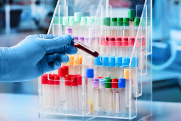 technician holding a blood sample tube for analysis in the laboratory / doctor with blood sample to...