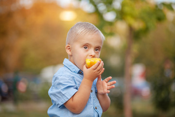 The daily life of a child with disabilities. A boy with Down syndrome eats a peach. Chromosomal and...