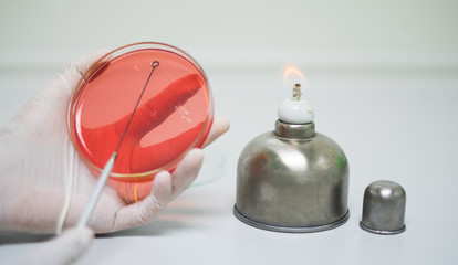 The microbiologist hand is streaking agar plate nearly with alcohol burner with flame