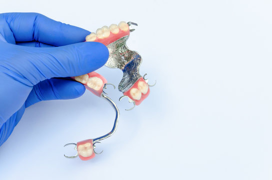 orthopedic dentistry. prosthetics concept with removable dentures. a dentist&rsquo;s hand in a glove holds a set of clasp prostheses on the upper and lower jaws. light background