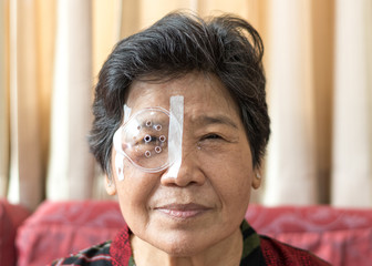 Cataract treatment after surgery by caregiver concept. Asia old woman placed protective shield over...
