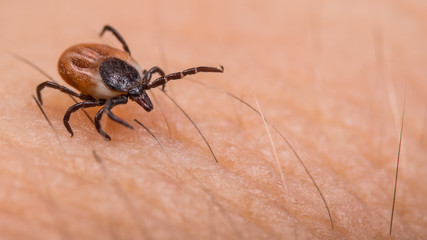 Crawling deer tick on human hairy skin background. Ixodes ricinus or scapularis. Dangerous parasitic mite on blurry pink texture. Disgusting biting insect. Encephalitis infection. Tick-borne diseases. - obrazy, fototapety, plakaty