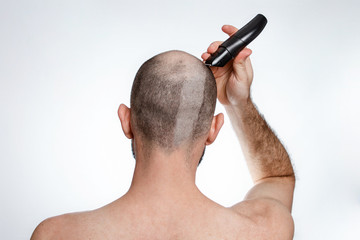 The concept of baldness and alopecia. A man holds a hair clipper and shaves the hair on top of his...