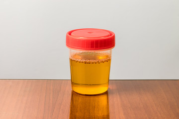 Plastic container with sample of urine for analysis