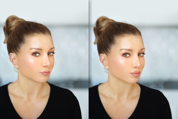 Beauty injections.Concept of rejuvenation.Lip augmentation	