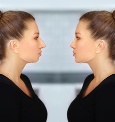 face beauty, nose and chin correction, rhinoplasty, genioplasty