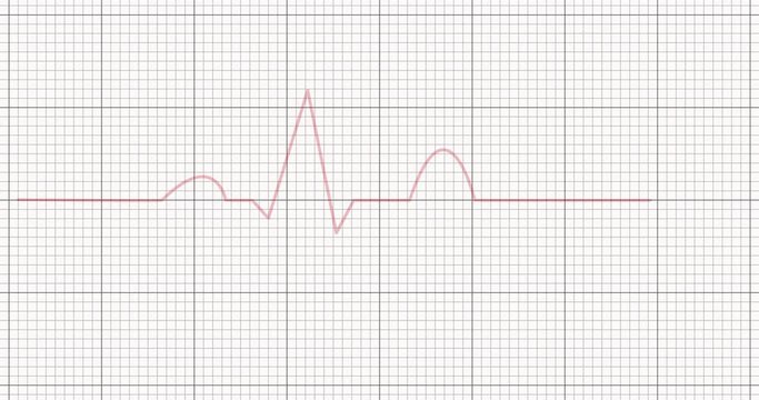 Graphic of heart beat