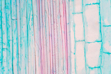 Plant vascular tissue under the microscope view.