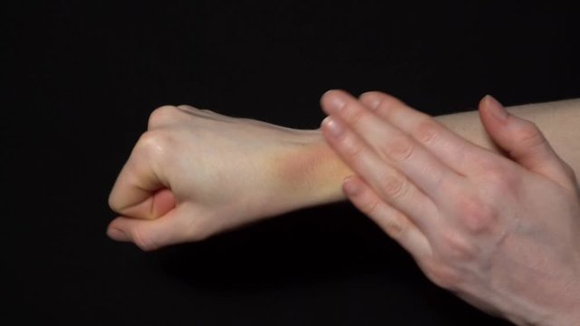 Female hands with a big bruise on a black background. Domestic violence or unequal treatment. Treatment with bruise ointments. 4k footage.