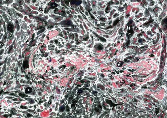 texture stone white black pink