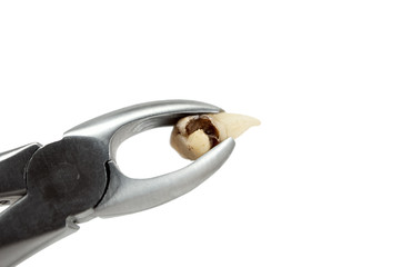 extractive caries tooth in surgical forceps on white background close-up macro, upper wisdom molar, destroyed tooth filling, isolated