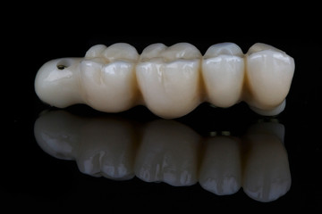 ceramic prosthesis after implantation with reflection