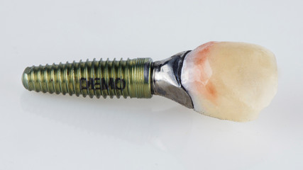 demo dental implant and crown on a white background