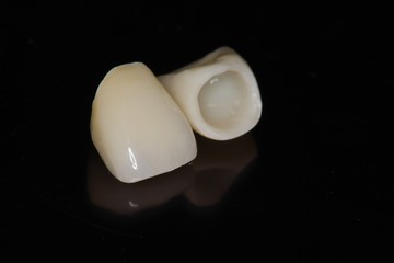 ジルコニアクラウン