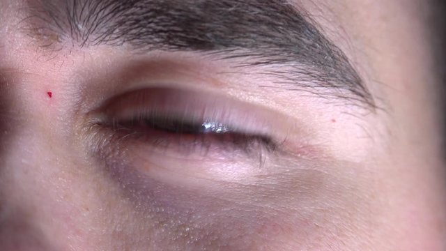 Eye pupil react to light
