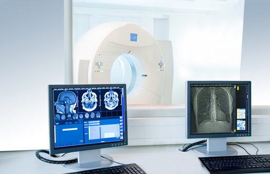 Computertomogrphie Arbeitsplatz mit Schnittbildern auf Monitoren, im Hintergrund CT Gerät in der Radiologie