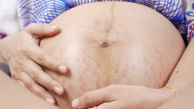 Hands rubbed pregnant belly with pregnant stretch marks or scar. 