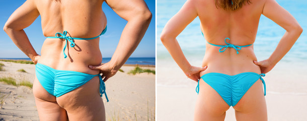 Woman in bikini from back before and after weight loss - obrazy, fototapety, plakaty