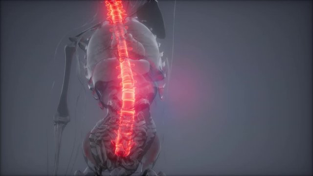 backache in backbone. science anatomy scan of human spine bones glowing