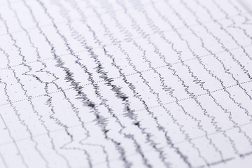Cardiogram on a sheet of paper close-up. Texture of pulsed waves.