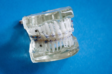 Plastic jaw model for stomatology and maxillofacial surgery.