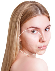 Young blond woman with zoom circle before and after retouch.