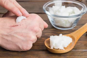 Hand applying natural coconut oil on a Skin wound. Wooden background.