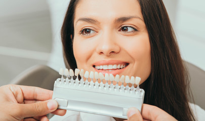 teeth palette with different shades of teeth near female smiling. Stomatology, whitening teeth,...