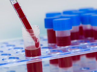 filling up a tube with a blood sample