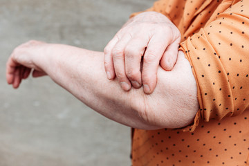 Older woman elbow pain. Rheumatism, arthritis, joint pain