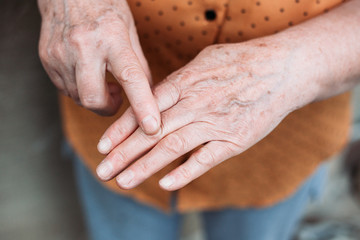 Older woman hands. Rheumatism, arthritis, joint pain