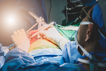Close up group of surgeons in Surgery operating room. Medical team of surgeons doing surgery in...