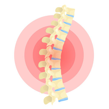 Spinal Cord Cartoon Images – Browse 513 Stock Photos, Vectors, and Video |  Adobe Stock