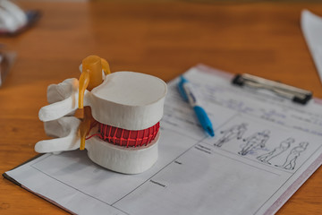 Lumbar spine model on table in Physiotherapy clinic