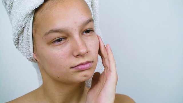 Pessimistic teenage girl examining her face with acne after shower