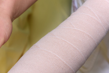 Lymphedema management: Wrapping Lymphedema Hand and Arm using multilayer bandages to control Lymphedema. Part of complete decongestive therapy (cdt) and manual lymphatic drainage (MLD)