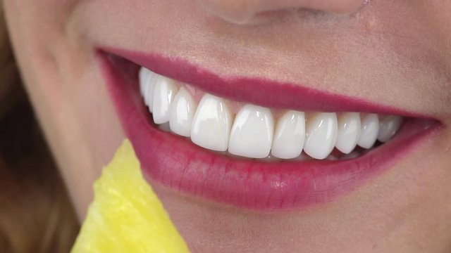 smiling girl with dental veneers of color bleach one and pink lips bites piece of yellow juicy pineapple slow motion closeup