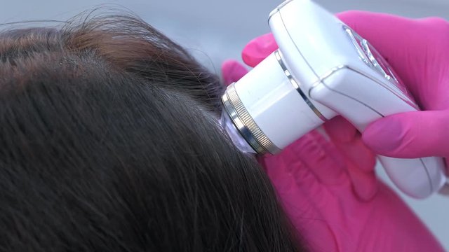 Doctor trichologist examines woman patient's hairs using trichoscope in clinic, hand in gloves closeup. Procedure of trichoscopy hair. Computer trichoscopy, modern technologies in medicine.