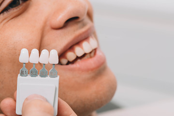 Dentist sampling shades teeth ,he holding teeth shades palette near male mouth. Whitening teeth
