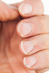 Dirty and neglected hand and damaged and overgrown nails of an adult male, isolated on a white...