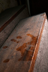 Dusty surface. Dirty home. Asthma disease