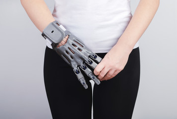 A girl with a prosthesis printed on a 3D printer holds the fingers of the prosthesis with her hand.