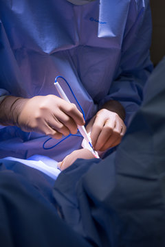 Close up of surgeon's hands cauterizing 